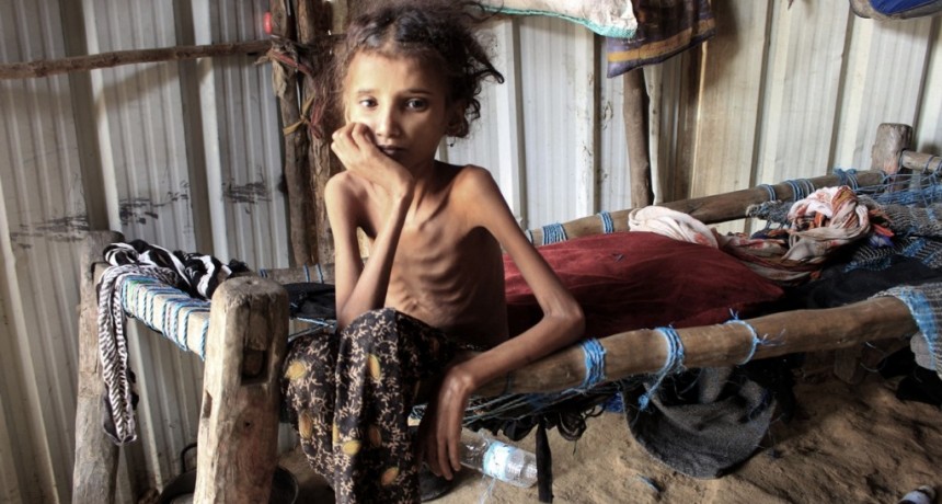  Más de 30 millones de niños sufren desnutrición aguda en el mundo 