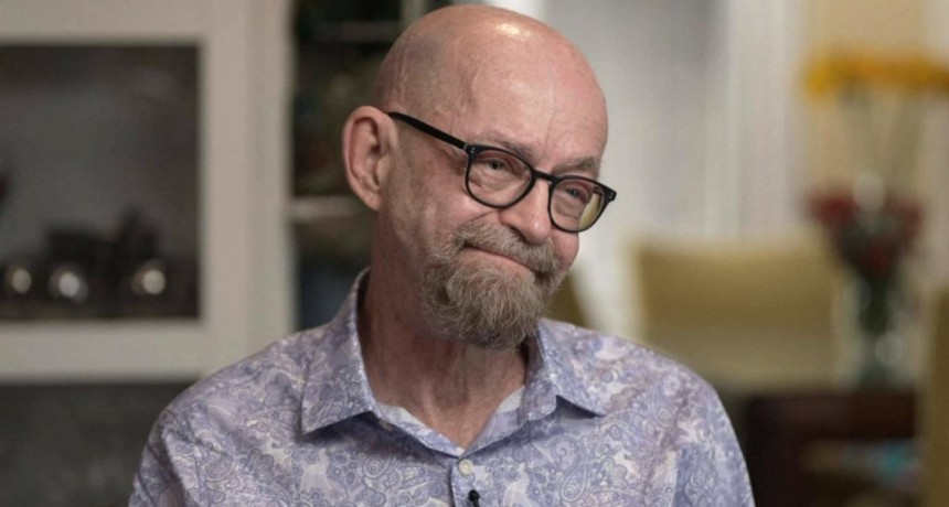  Células madre: un hombre es la quinta persona en el mundo en lograr la remisión de leucemia y VIH 