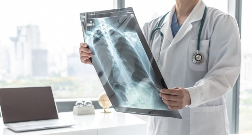  Aprobaron una nueva droga para un subtipo de c&aacute;ncer de pulm&oacute;n 