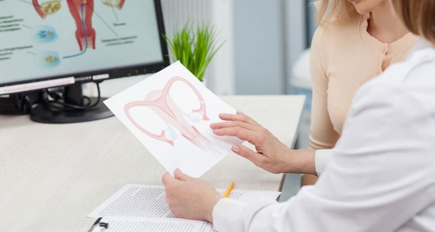  M&aacute;s del 70% de los casos de c&aacute;ncer de ovario se detectan en etapa avanzada 