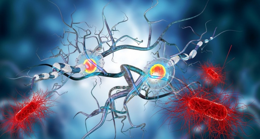  Detectaron una variante gen&eacute;tica que causa el empeoramiento de la esclerosis m&uacute;ltiple 
