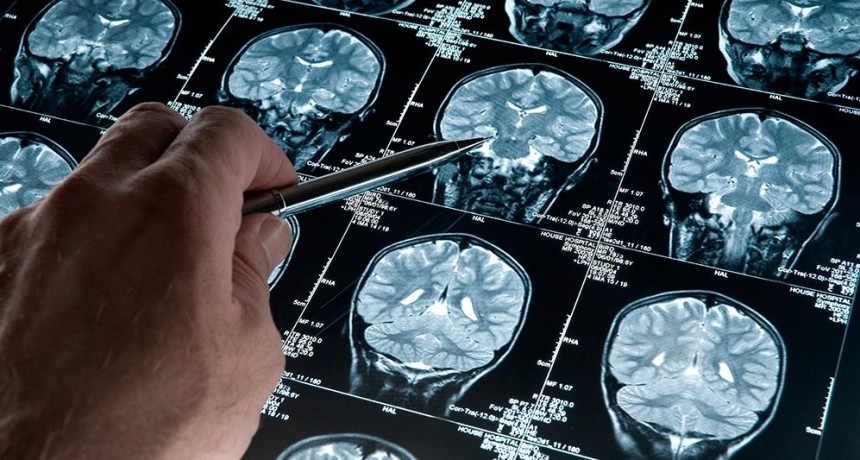  Hallazgo científico: los tumores cerebrales 