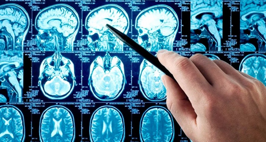  Científicos argentinos crearon un asistente virtual móvil para reconocer síntomas de ACV 